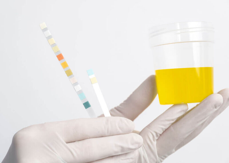 urine acidity