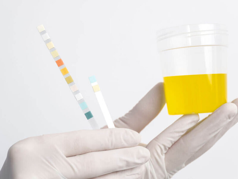 urine acidity